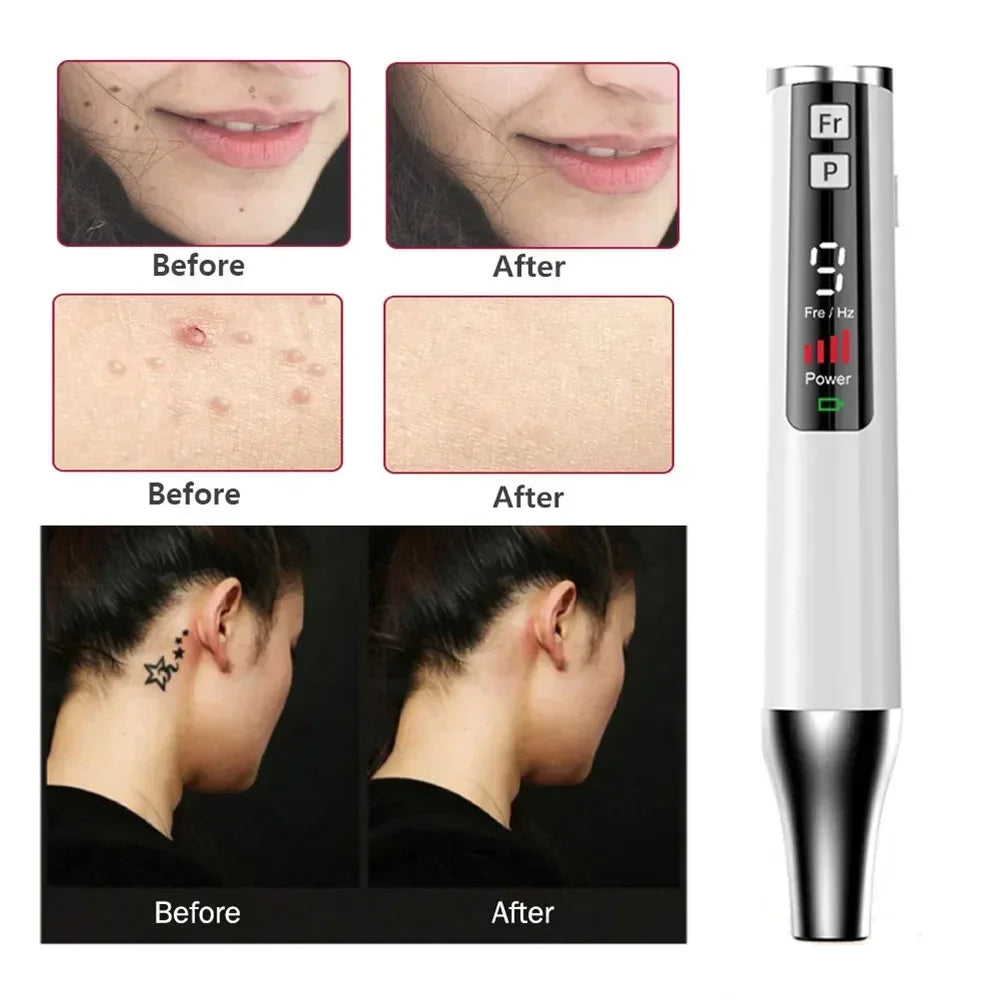 LÁSER PARA  TRATAMIENTO TOPICO