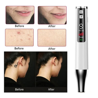 LÁSER PARA  TRATAMIENTO TOPICO