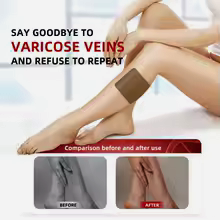 30 Parches de Varices para Circulacion